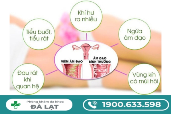 Hình ảnh minh họa